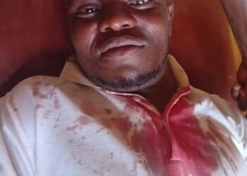 Victim of the ADC meeting attack in Ejule